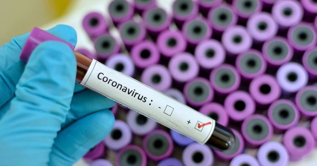 Virus Corona Tidak Menular Lewat Barang